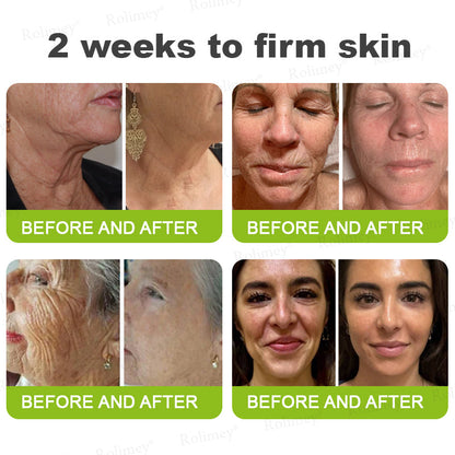 💍🎁Made and shipped from Canada 💫Rolimey® Botox & Vita-A Retinol Shot Wrinkle-Lift Tightening cream - Last Day Promotion 70% OFF