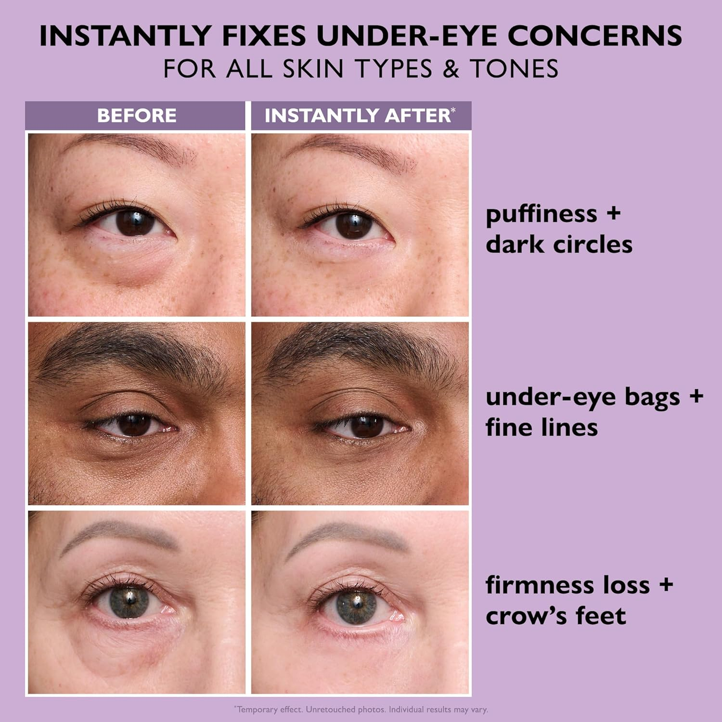 ⚡ 50% OFF Ends Soon!⚡ Perfection Eye Tightener, 2025 New Perfection Primer Tightener, for periorbital puffiness, Smooth periorbital fine lines and wrinkles, Tightens Eye Skin, Brightens Tired Eyes