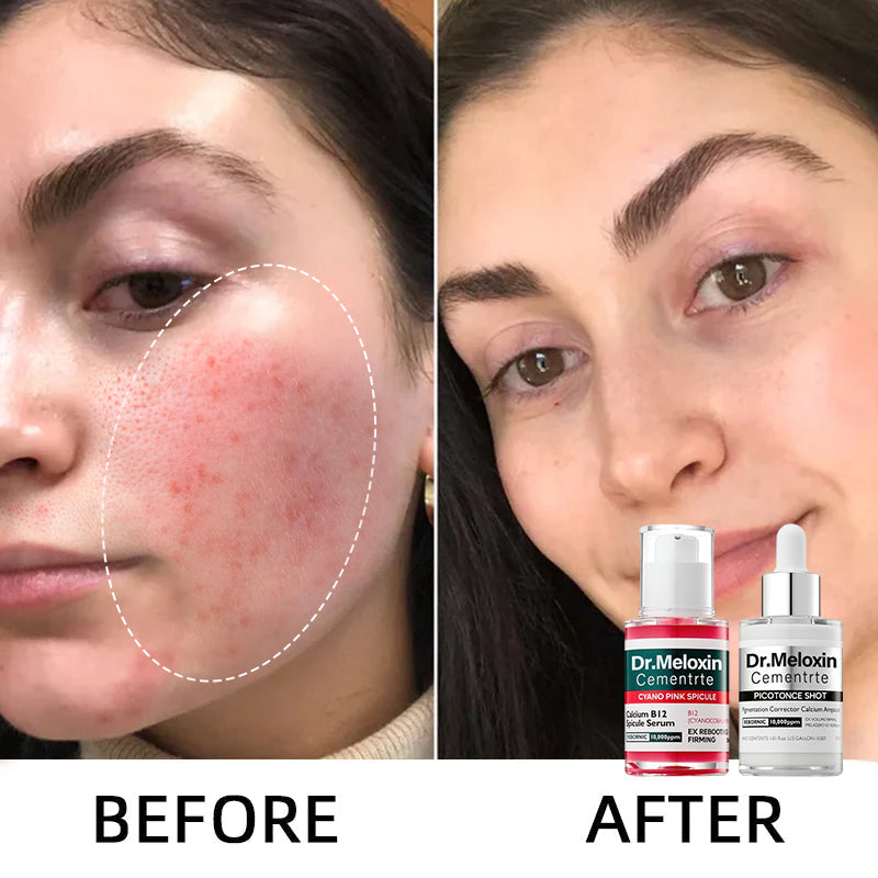 🌷Glass Skin Kit – Fade Blemishes & Shrink Pores Fast | 50% OFF Today Only