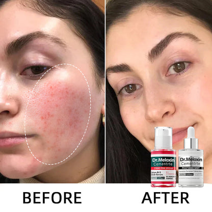 🌷Glass Skin Kit – Fade Blemishes & Shrink Pores Fast | 50% OFF Today Only