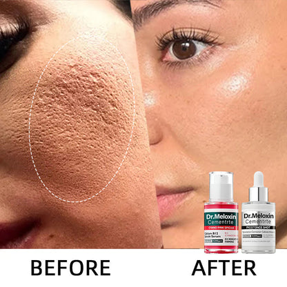 🌷Glass Skin Kit – Fade Blemishes & Shrink Pores Fast | 50% OFF Today Only
