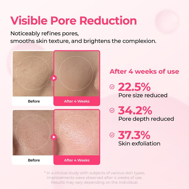🌷Glass Skin Kit – Fade Blemishes & Shrink Pores Fast | 50% OFF Today Only