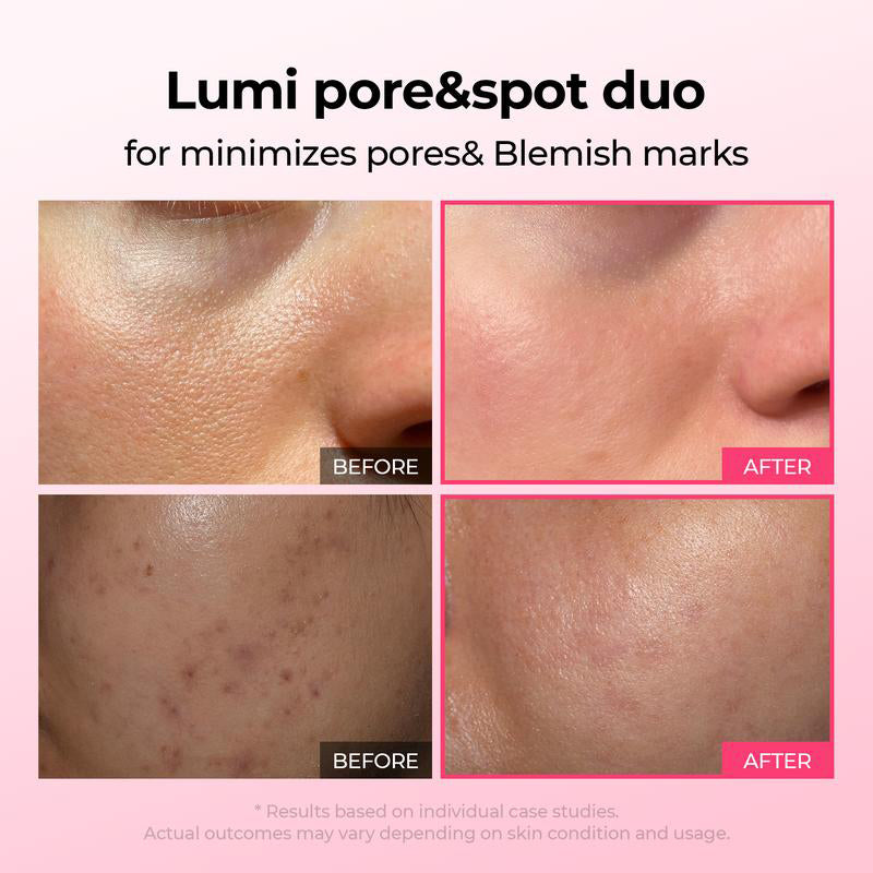 🌷Glass Skin Kit – Fade Blemishes & Shrink Pores Fast | 50% OFF Today Only