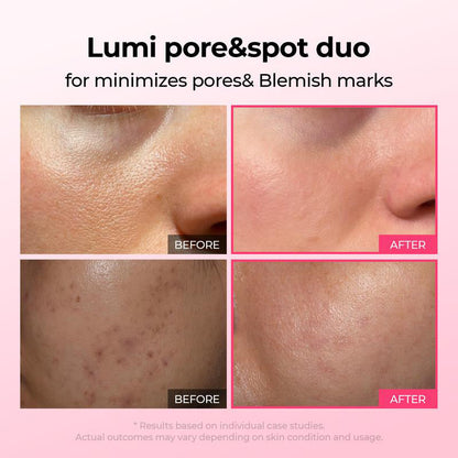 🌷Glass Skin Kit – Fade Blemishes & Shrink Pores Fast | 50% OFF Today Only
