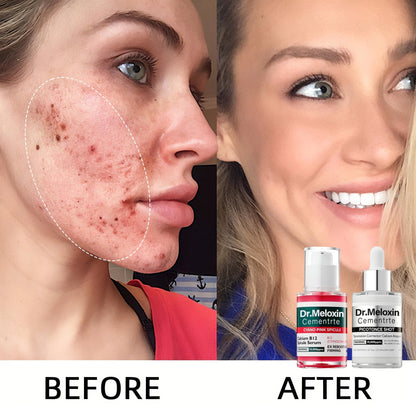 🌷Glass Skin Kit – Fade Blemishes & Shrink Pores Fast | 50% OFF Today Only