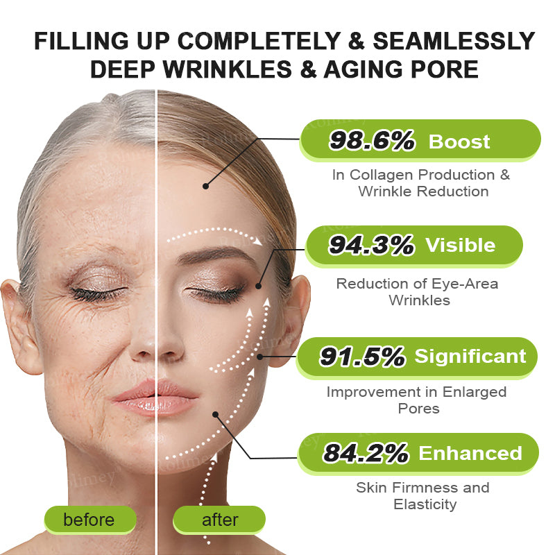 💍🎁Made and shipped from Canada 💫Rolimey® Botox & Vita-A Retinol Shot Wrinkle-Lift Tightening cream - Last Day Promotion 70% OFF