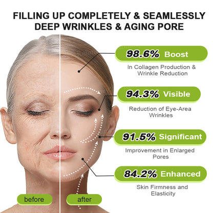💍🎁Made and shipped from Canada 💫Rolimey® Botox & Vita-A Retinol Shot Wrinkle-Lift Tightening cream - Last Day Promotion 70% OFF