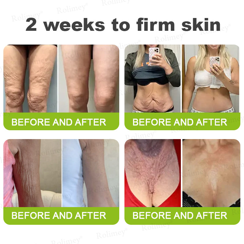 💍🎁Made and shipped from Canada 💫Rolimey® Botox & Vita-A Retinol Shot Wrinkle-Lift Tightening cream - Last Day Promotion 70% OFF