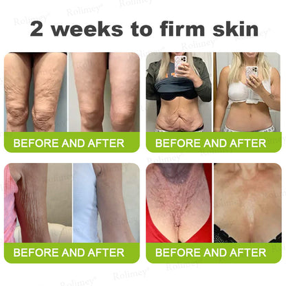 💍🎁Made and shipped from Canada 💫Rolimey® Botox & Vita-A Retinol Shot Wrinkle-Lift Tightening cream - Last Day Promotion 70% OFF