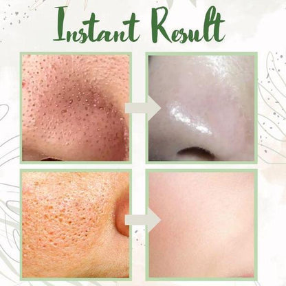 🌼50% OFF🌿 Holy Basil Bubble Deep Mask — 13% Herbal Power for Clear & Fresh Skin