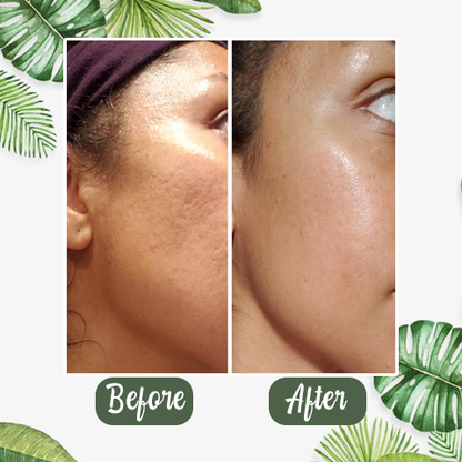 🌼50% OFF🌿 Holy Basil Bubble Deep Mask — 13% Herbal Power for Clear & Fresh Skin