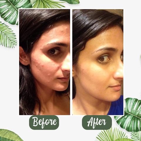 🌼50% OFF🌿 Holy Basil Bubble Deep Mask — 13% Herbal Power for Clear & Fresh Skin